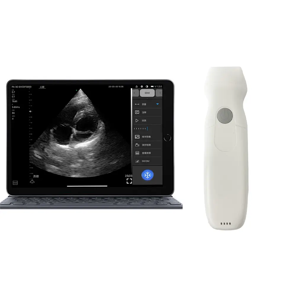 PD2 cardiale echoprobe met CW-doppler