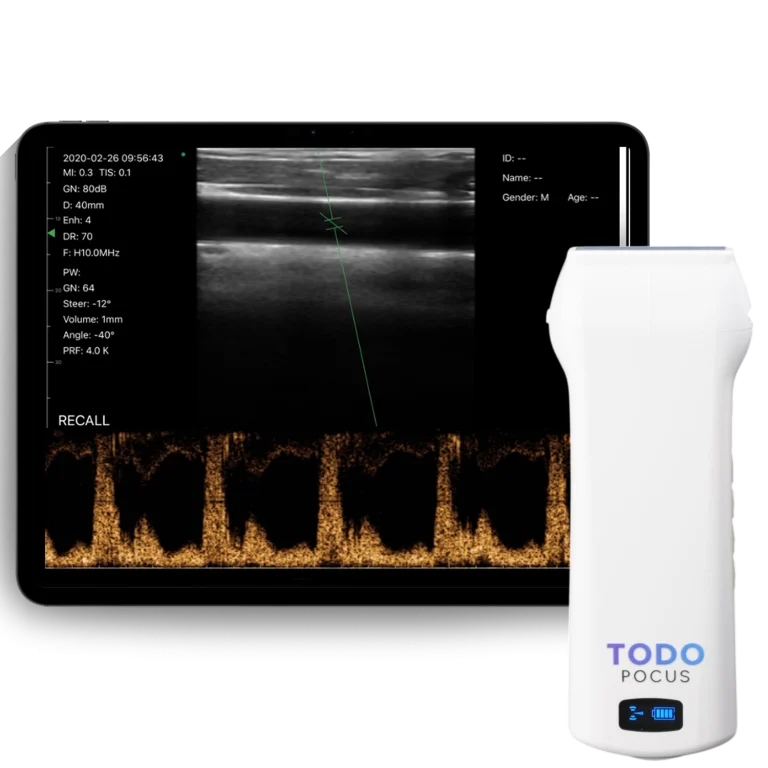 l10h guide handheld ultrasound linear probe with magnetic navigation for precise needle guidance