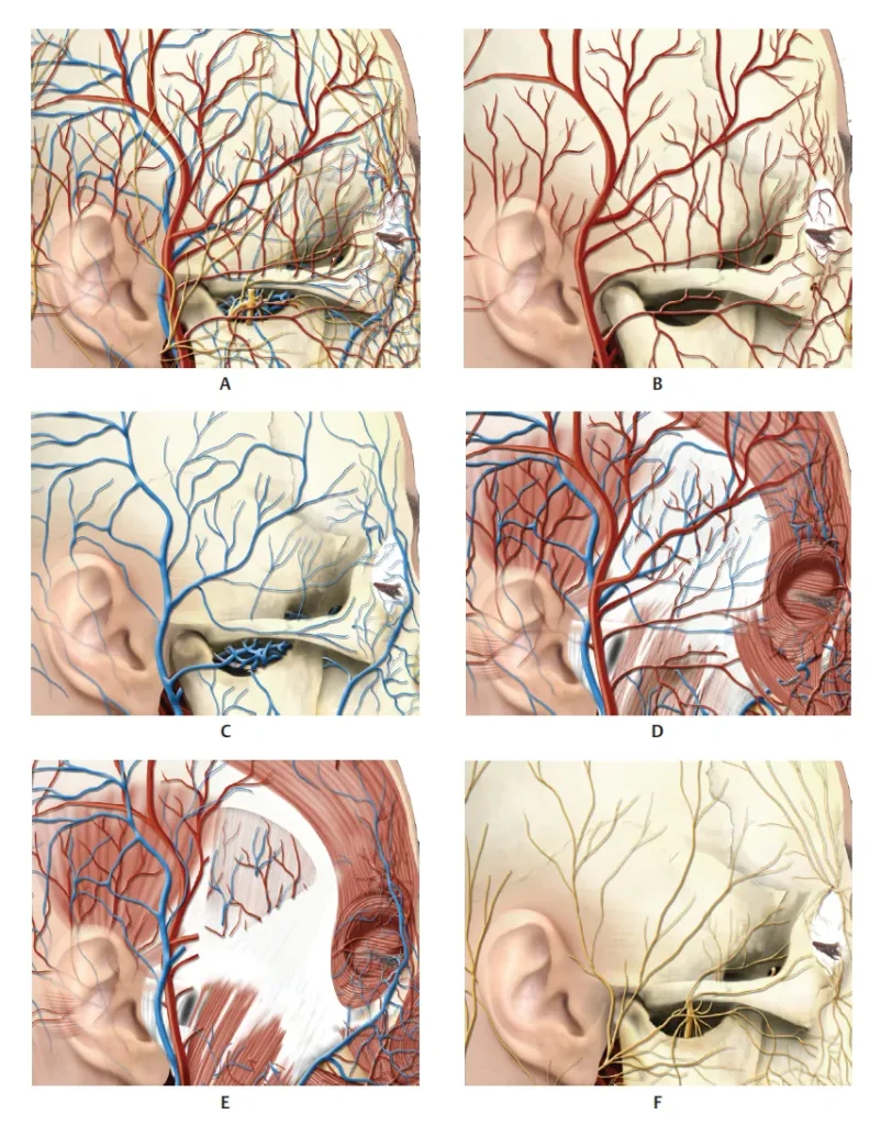Temporal Innervation How to Avoid Filler Complications Using Portable Ultrasound?