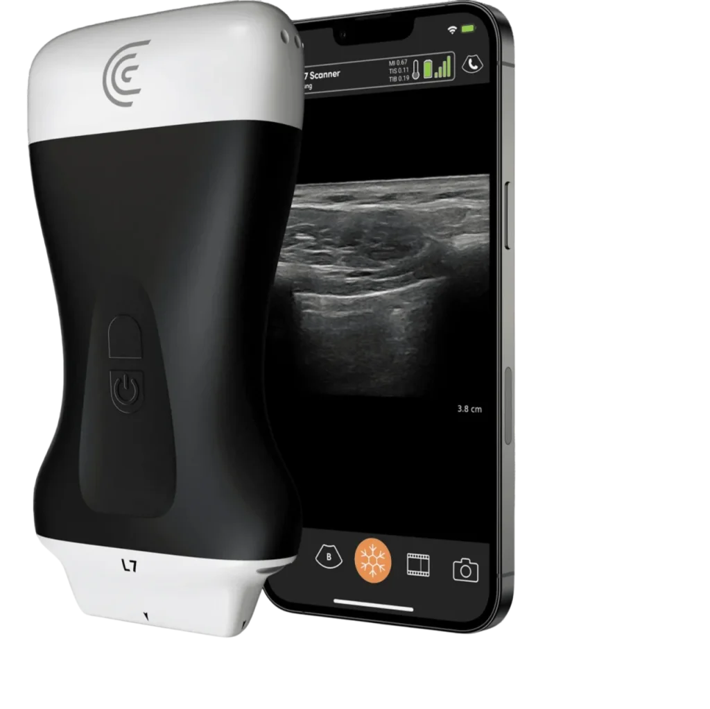 clarius l7 hd3