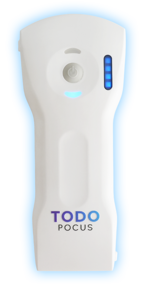 todopocus d3 ultra handheld ultrasound one device for whole body scan