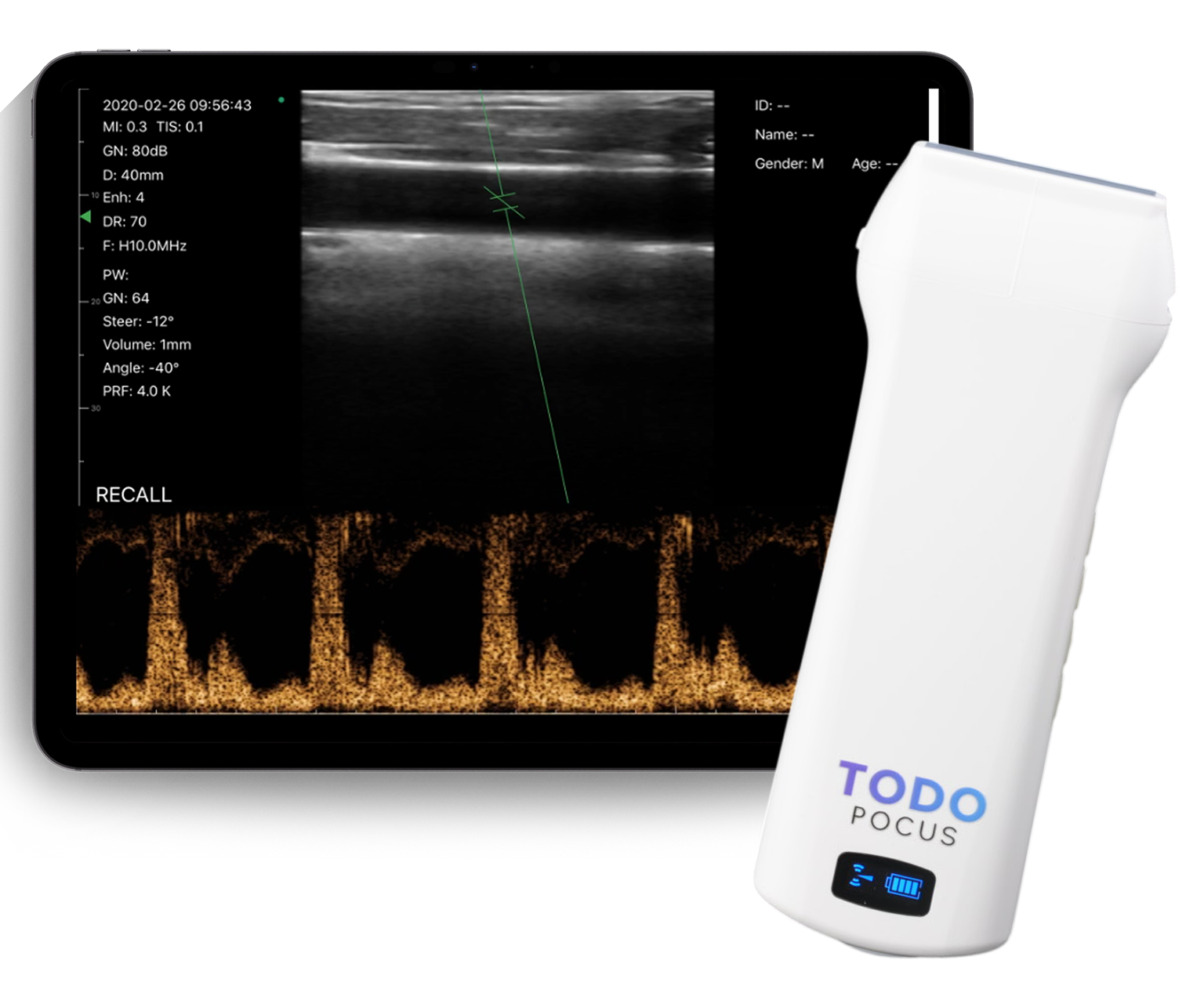 MSK、疼痛・整形外科 – TodoPocus™