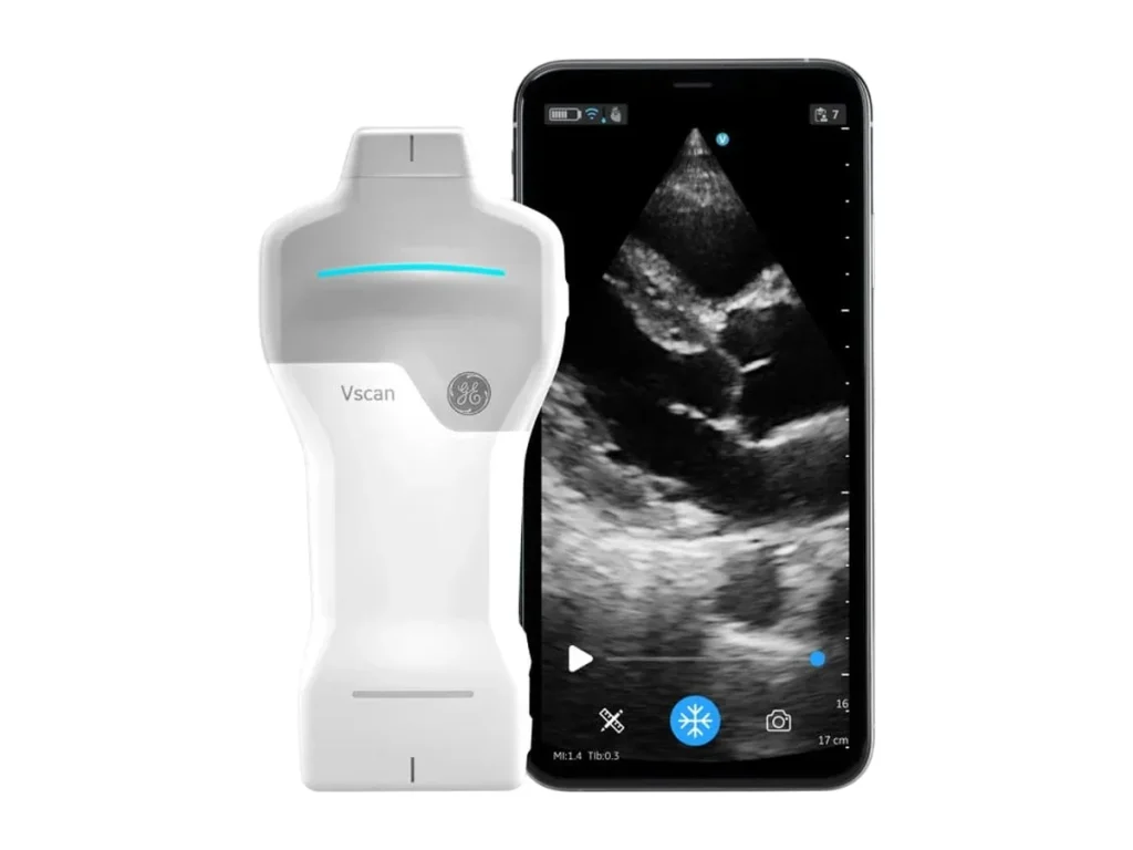 ge vscan air sl dual array handheld ultrasound with a cardiac view on a phone, mindray te air i3p alternative