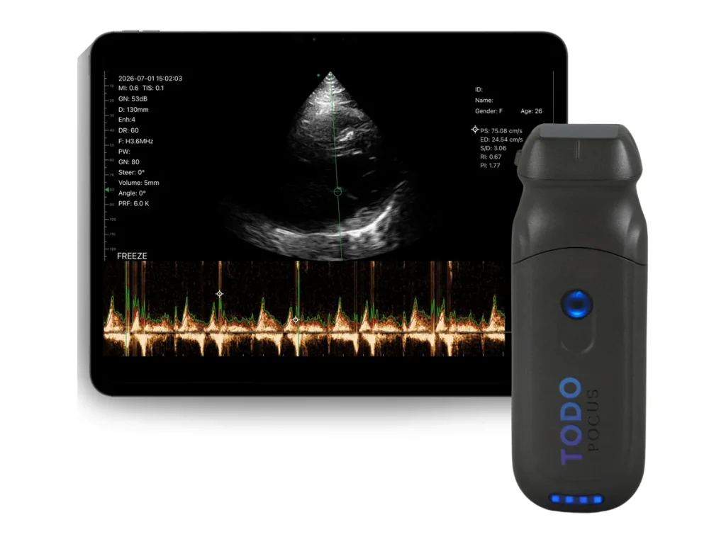 todopocus pd2 phased array handheld ultrasound with a cardiac pw doppler trace on a tablet, mindray te air i3p alternative