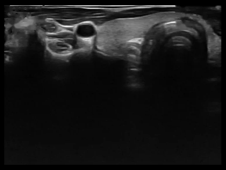 todopocus l10w 80 mm wide linear probe musculoskeletal b-mode at 10 mhz