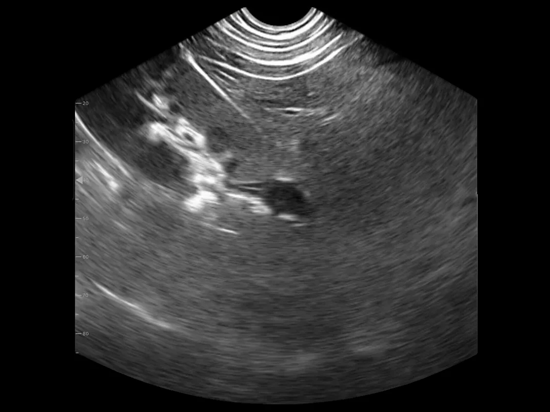 todopocus lc1 biplane intracavity probe convex-plane b-mode image